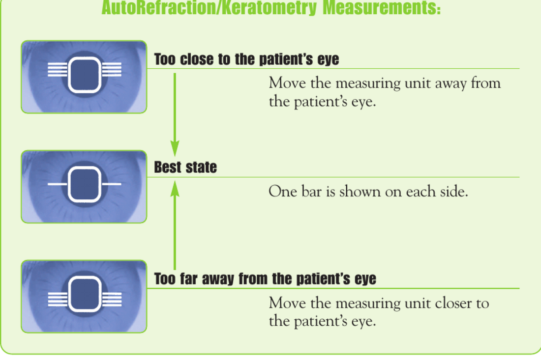 M3 autorefractor and keratometer alignment states showing too close, best state, and too far